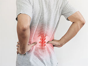 Herniated Disk: When Is Surgery Needed? 
