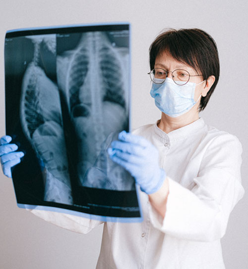 Diagnosing lung cancer