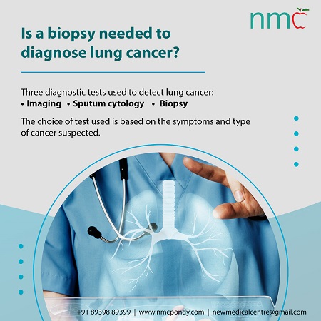 Is a biopsy needed to diagnose lung cancer?