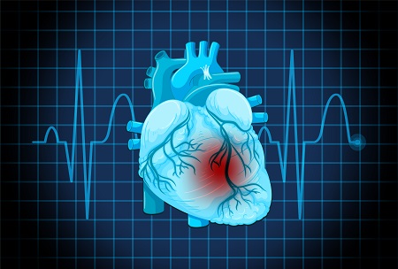 Minimally Invasive Radiofrequency Ablation for Irregular Heartbeat