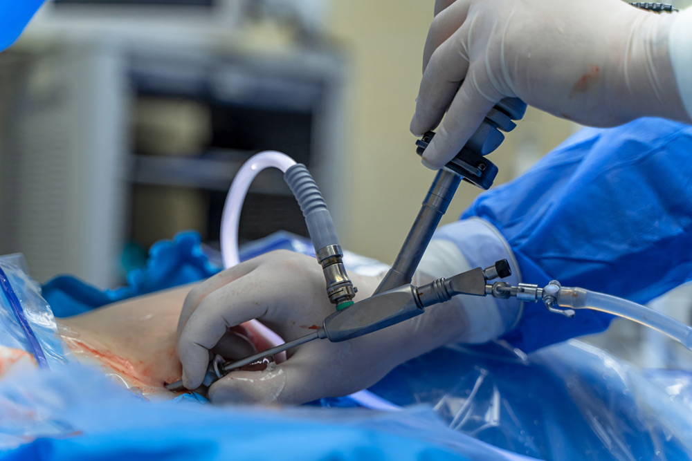 Minimally Invasive Techniques