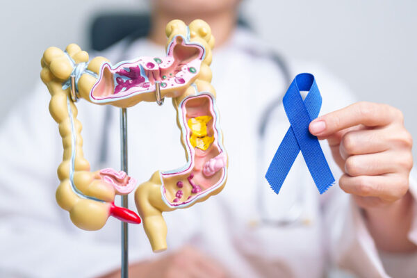 Is colon Cancer Hereditary